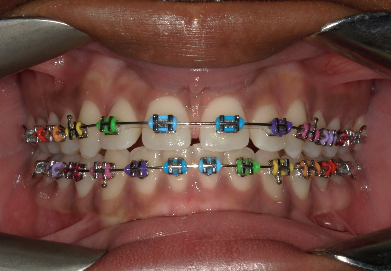 dental treatments bangi