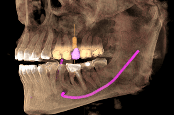 dental treatments bangi