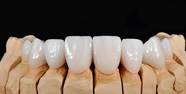 dental treatments bangi