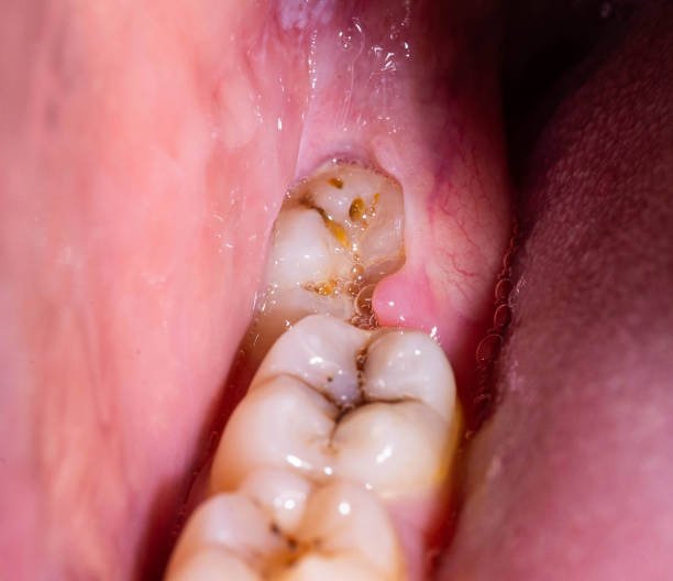dental treatments bangi