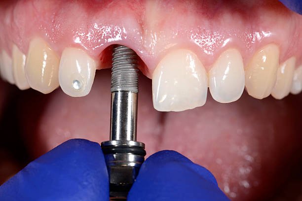 dental treatments bangi