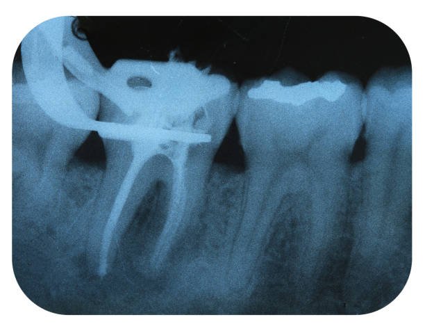 dental treatments bangi